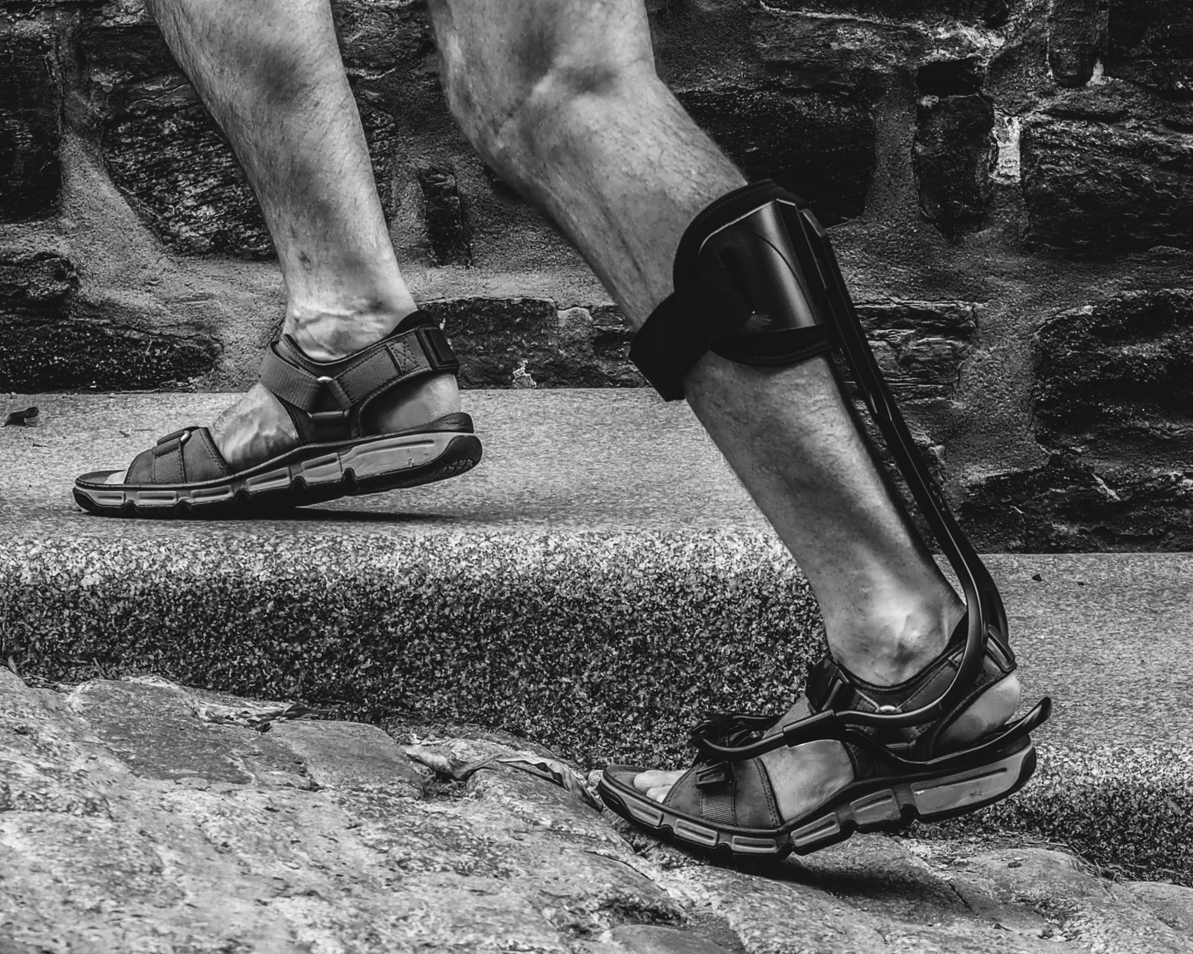 Xtern AFO Sandals